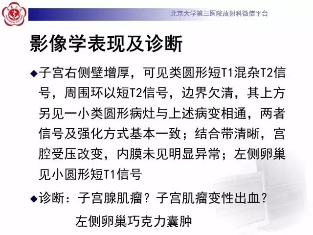 影像PPT - 【PPT】子宫腺肌病-6