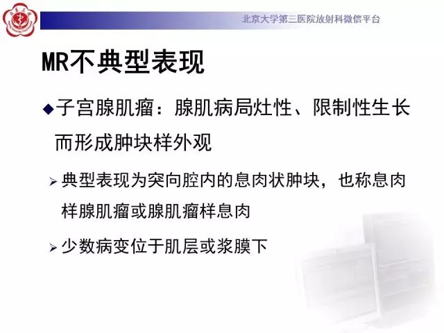 影像PPT - 【PPT】子宫腺肌病-22