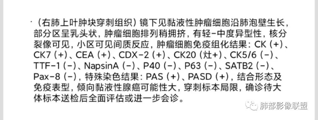 影像PPT - 【病例】粘液腺癌1例肺部CT影像特点及相关知识拓展-31 影像PPT - 【病例】粘液腺癌1例肺部CT影像特点及相关知识拓展-31