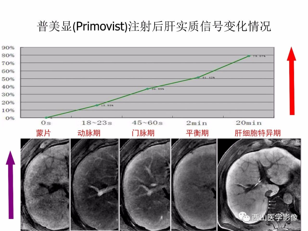 影像PPT - 【PPT】普美显临床应用病例解析-5