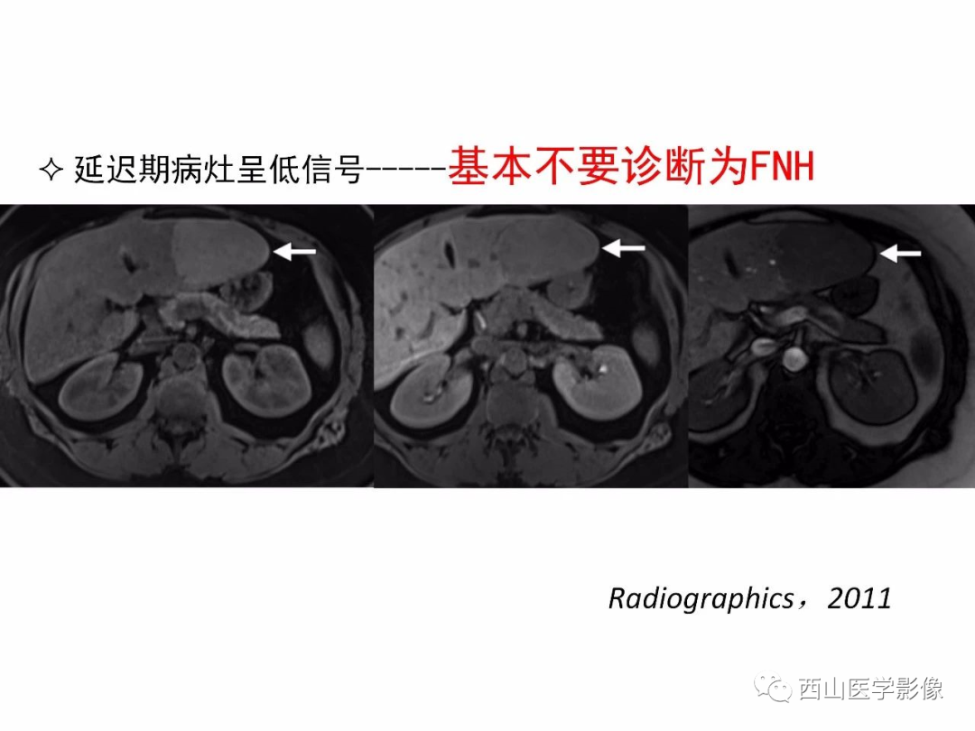 影像PPT - 【PPT】普美显临床应用病例解析-20