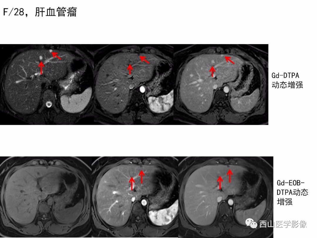 影像PPT - 【PPT】普美显临床应用病例解析-33
