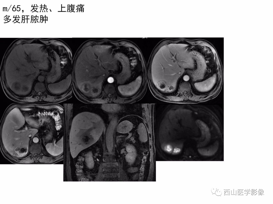 影像PPT - 【PPT】普美显临床应用病例解析-48