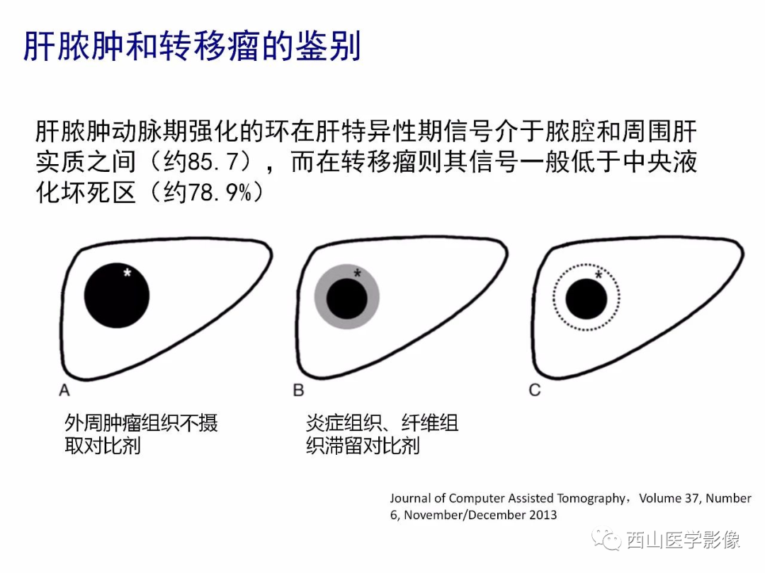 影像PPT - 【PPT】普美显临床应用病例解析-49