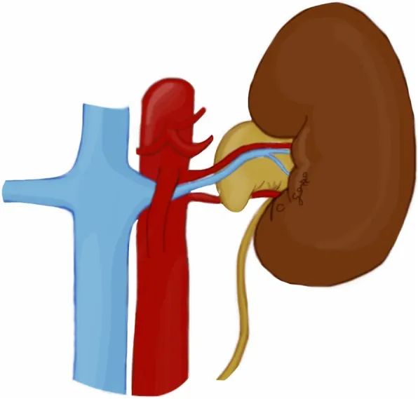 影像PPT - 7种腹部盆腔血管压迫综合征的CT表现-11