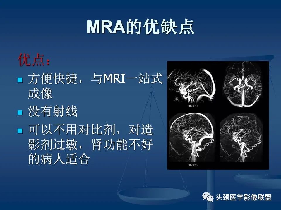 影像PPT - 【PPT】头颈部CTA和DSA对血管病变的诊断-4