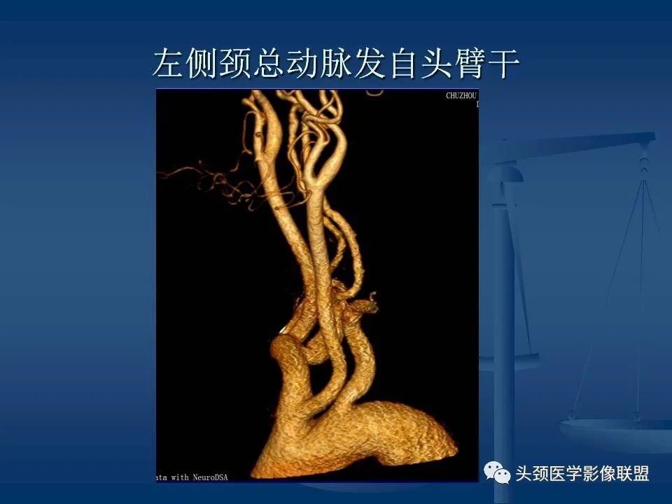 影像PPT - 【PPT】头颈部CTA和DSA对血管病变的诊断-8