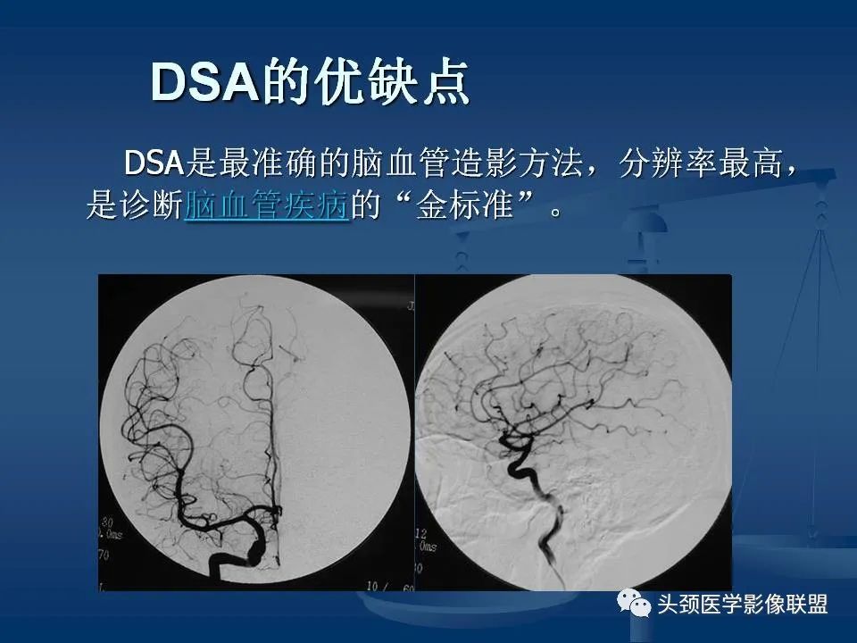 影像PPT - 【PPT】头颈部CTA和DSA对血管病变的诊断-11