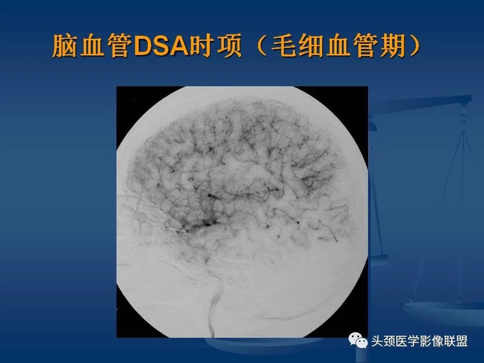 影像PPT - 【PPT】头颈部CTA和DSA对血管病变的诊断-16