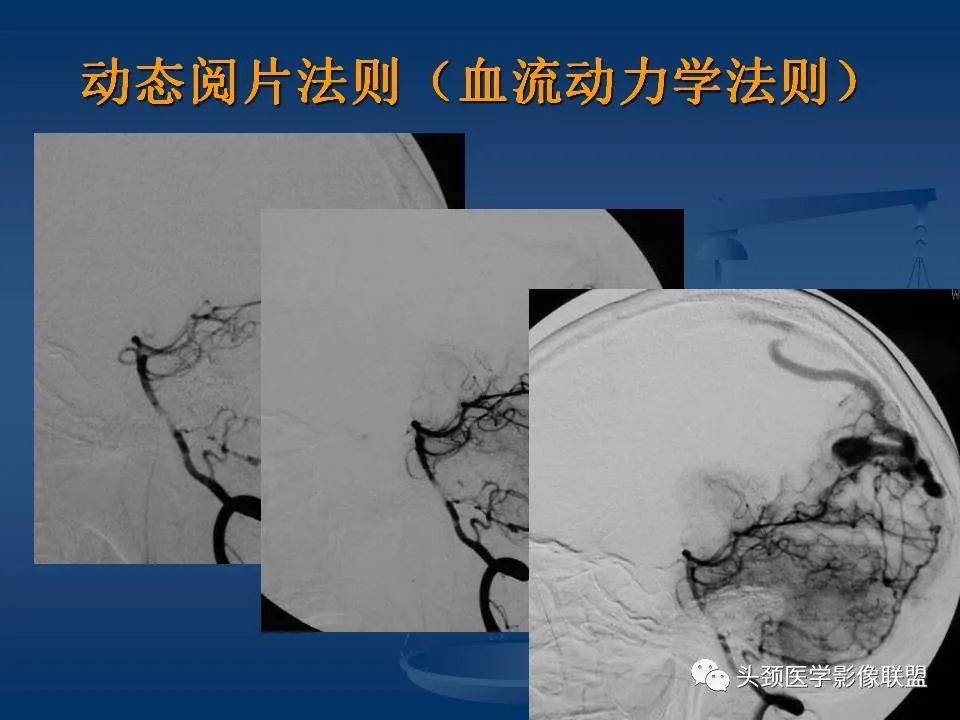 影像PPT - 【PPT】头颈部CTA和DSA对血管病变的诊断-19
