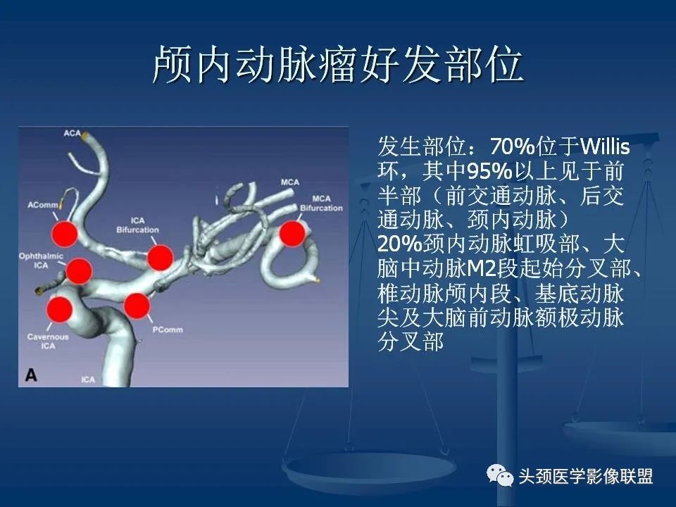 影像PPT - 【PPT】头颈部CTA和DSA对血管病变的诊断-33
