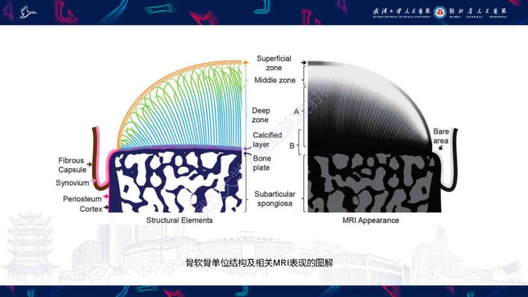 影像PPT - 【PPT】关节软骨损伤MRI诊断-3