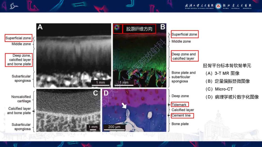 影像PPT - 【PPT】关节软骨损伤MRI诊断-4