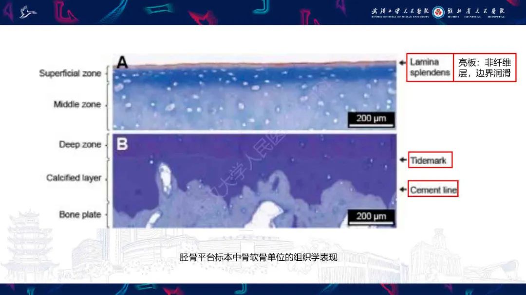 影像PPT - 【PPT】关节软骨损伤MRI诊断-5