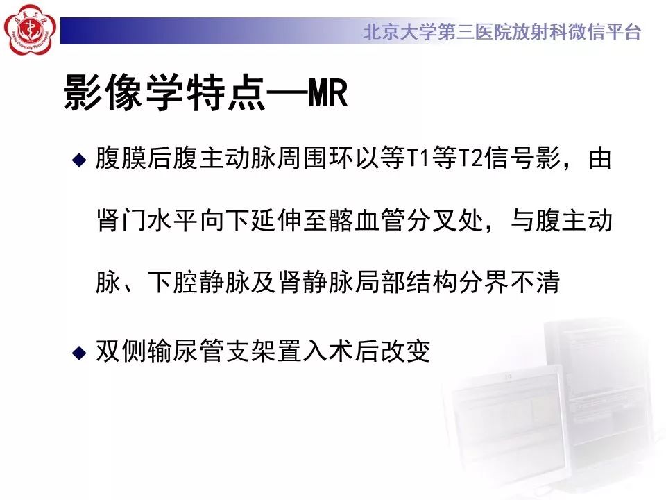 影像PPT - 【PPT】腹膜后纤维化-10