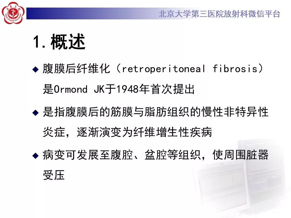 影像PPT - 【PPT】腹膜后纤维化-14