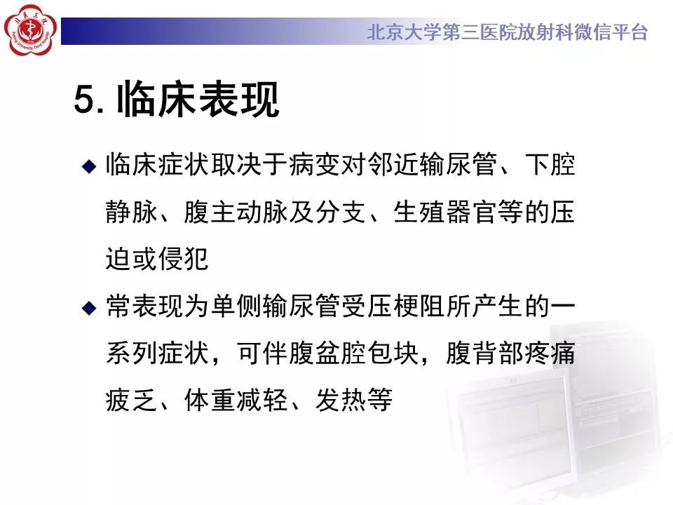 影像PPT - 【PPT】腹膜后纤维化-21