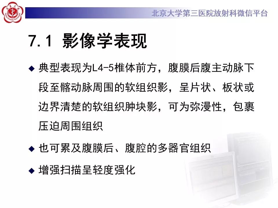 影像PPT - 【PPT】腹膜后纤维化-23