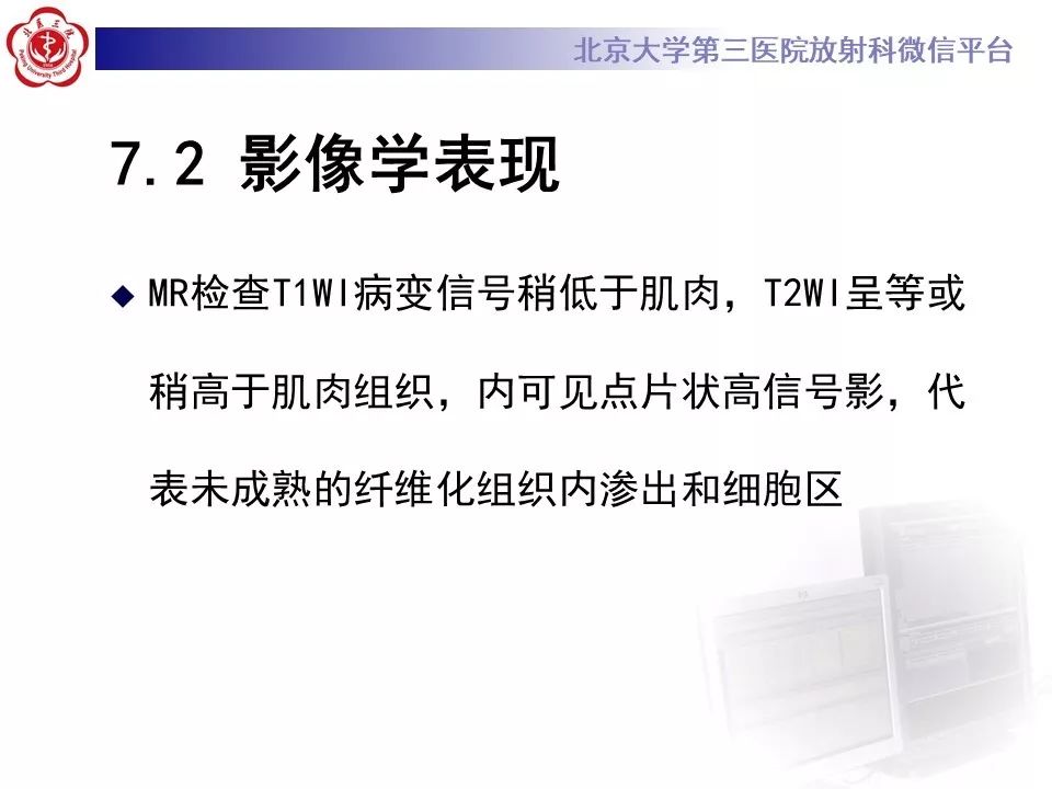 影像PPT - 【PPT】腹膜后纤维化-26