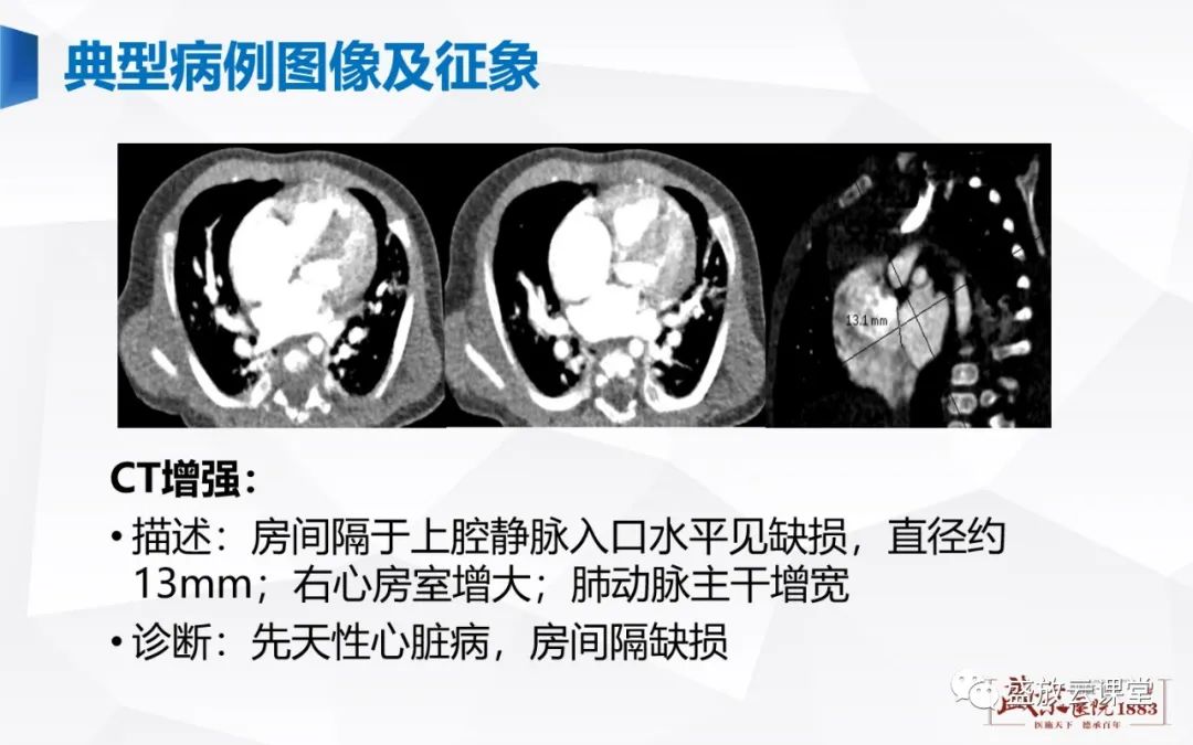 影像PPT - -4 影像PPT - -4