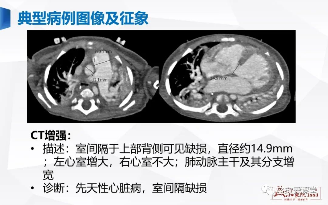 影像PPT - -8 影像PPT - -8