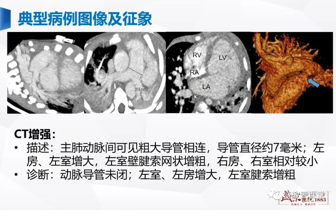 影像PPT - -12 影像PPT - -12