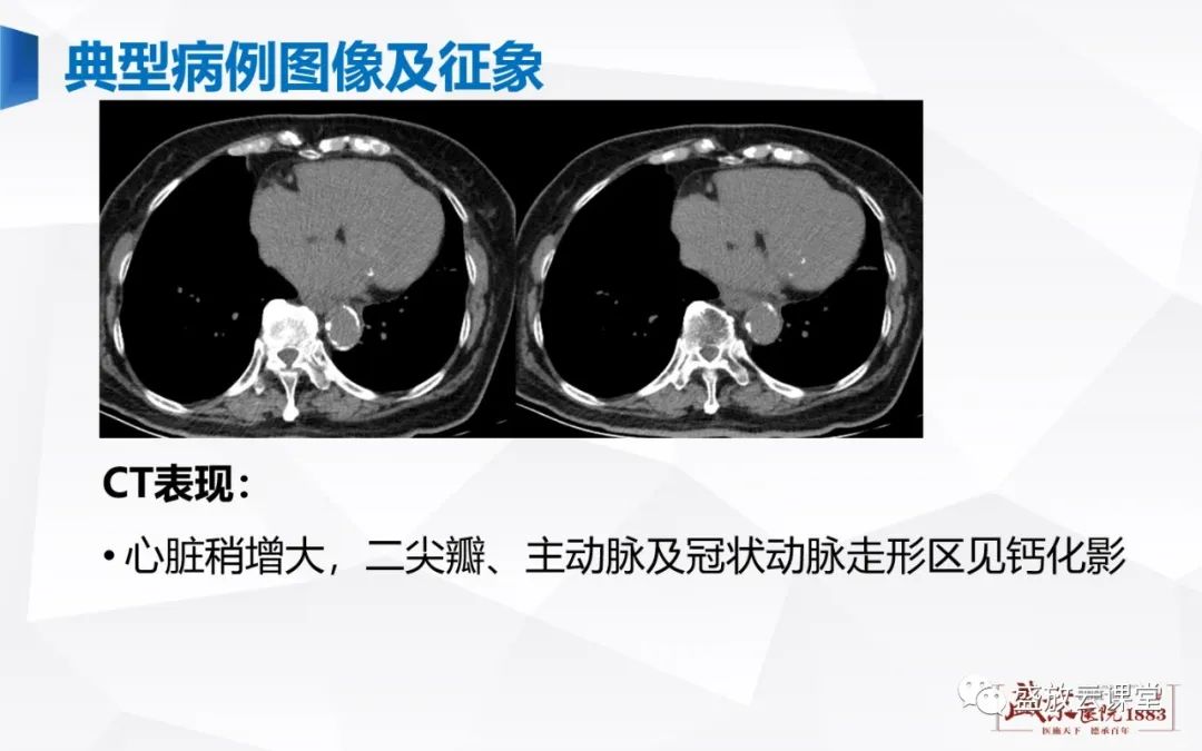 影像PPT - -20 影像PPT - -20
