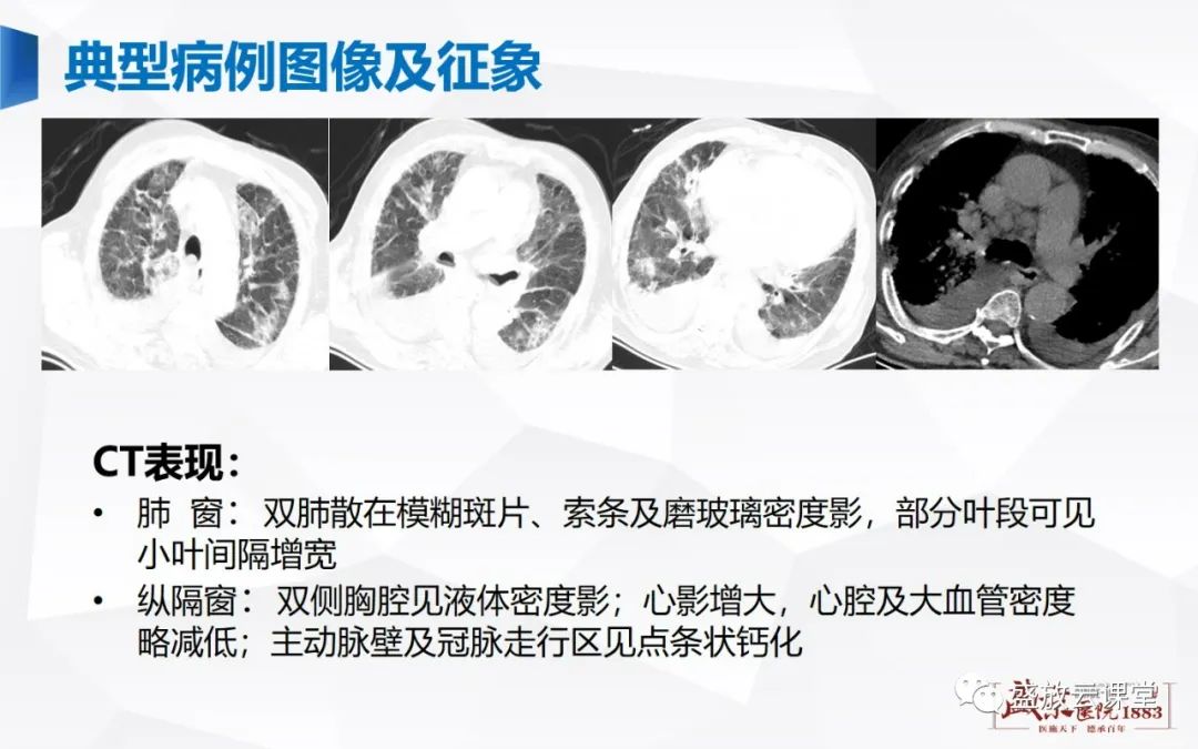 影像PPT - -25 影像PPT - -25