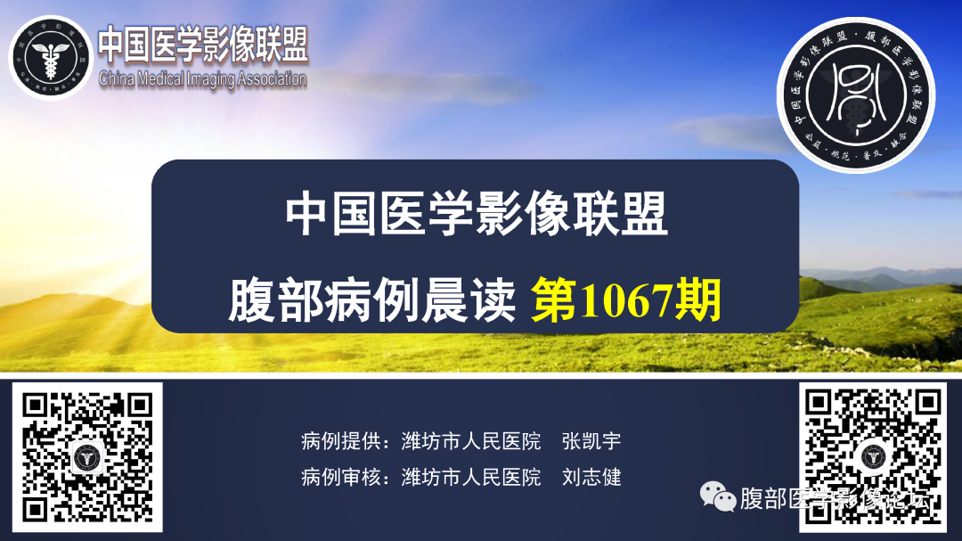 影像PPT - 【病例】肠系膜侵袭性纤维瘤病1例CT-1