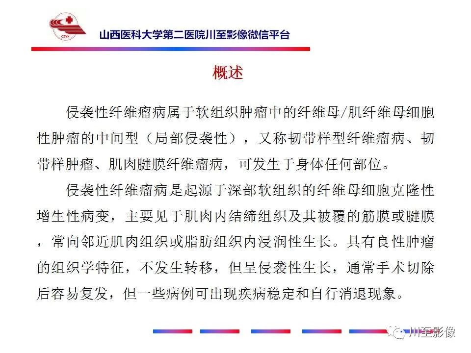 影像PPT - 【病例】肠系膜侵袭性纤维瘤病1例CT-16