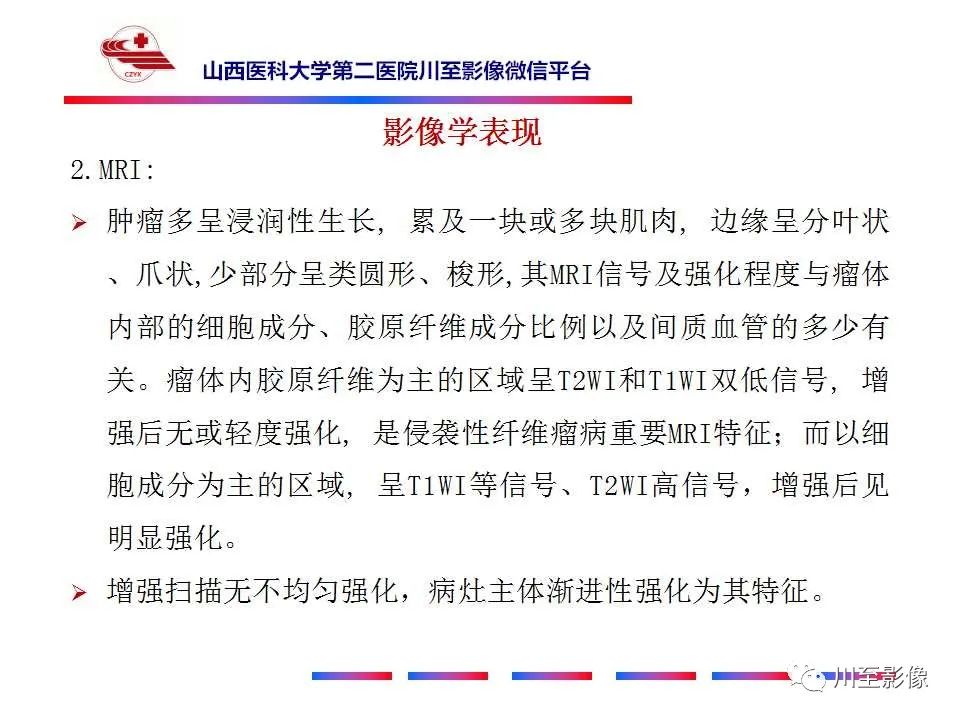影像PPT - 【病例】肠系膜侵袭性纤维瘤病1例CT-24
