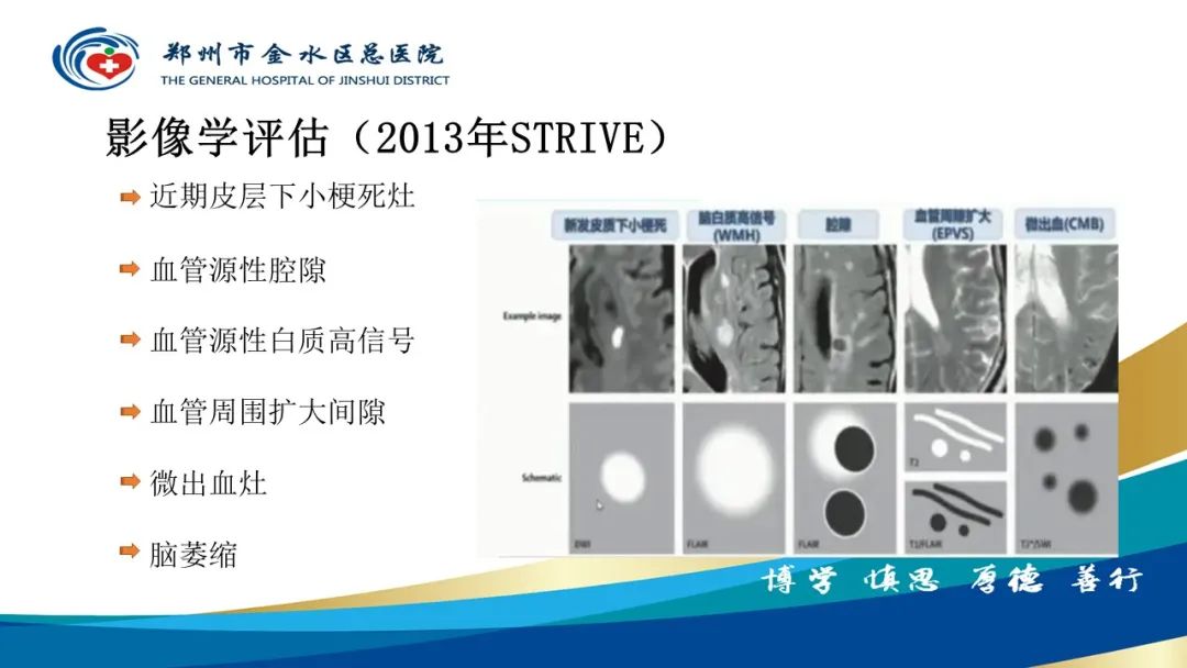 影像PPT - 【PPT】脑小血管病的影像诊断及鉴别诊断-6