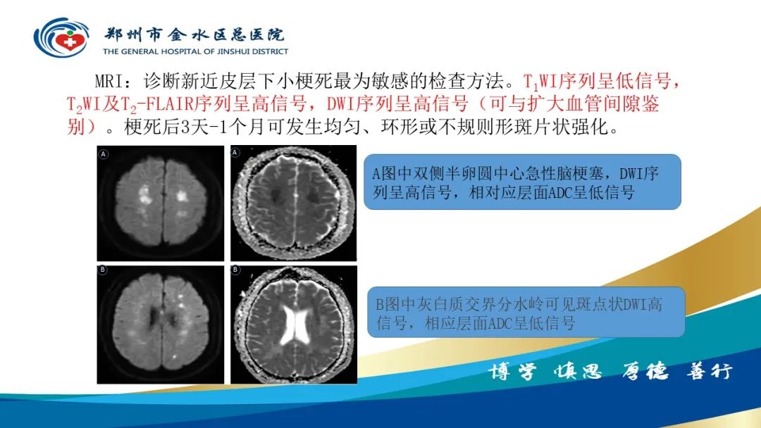 影像PPT - 【PPT】脑小血管病的影像诊断及鉴别诊断-8