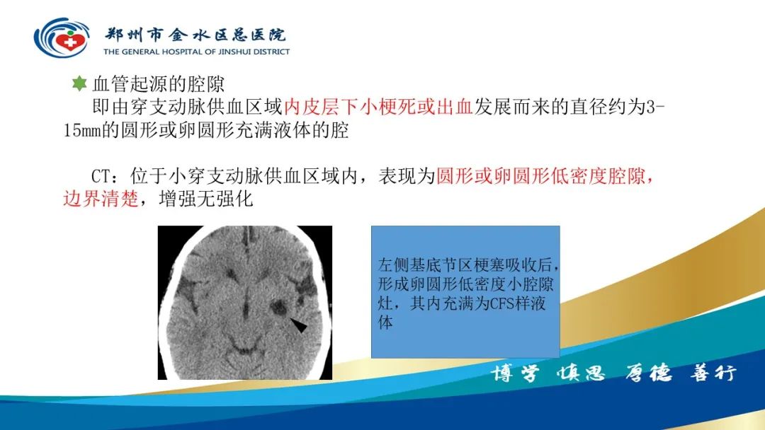 影像PPT - 【PPT】脑小血管病的影像诊断及鉴别诊断-10
