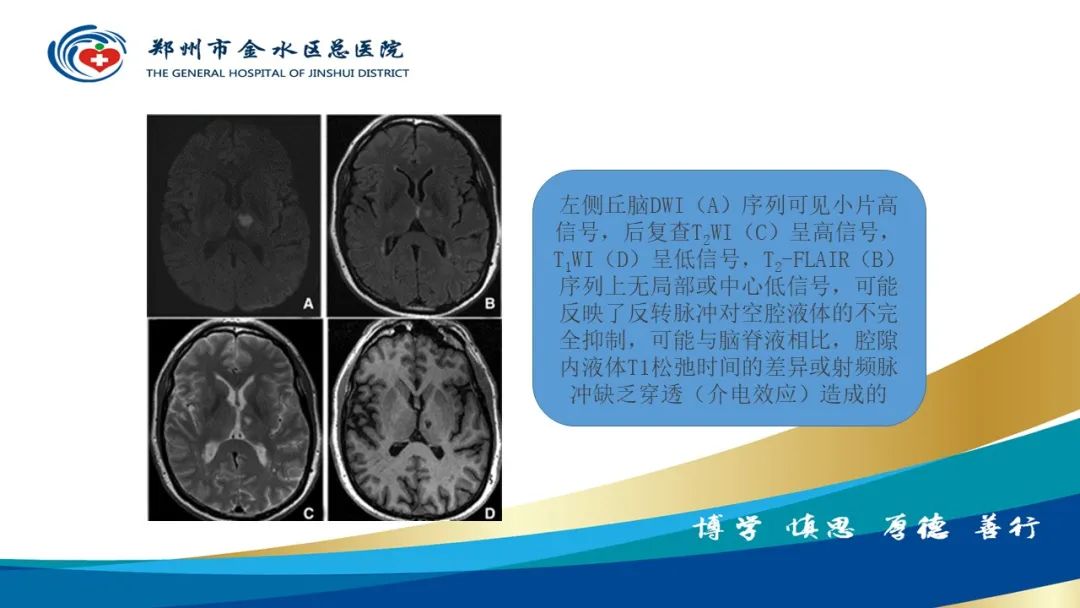 影像PPT - 【PPT】脑小血管病的影像诊断及鉴别诊断-12