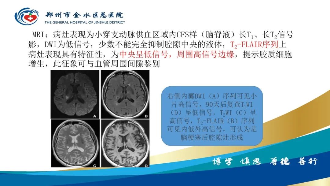 影像PPT - 【PPT】脑小血管病的影像诊断及鉴别诊断-11