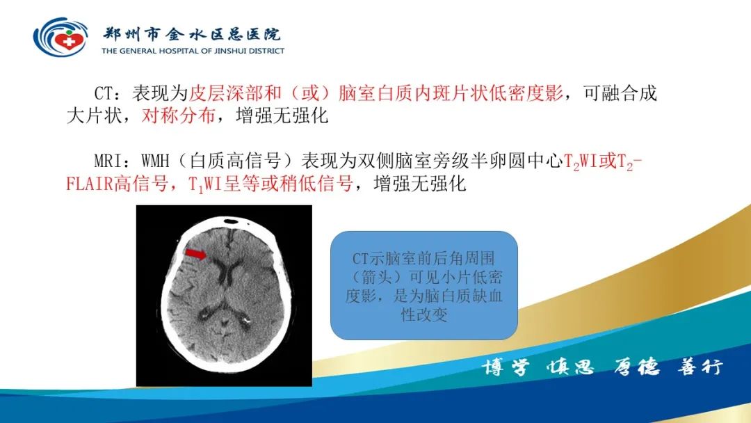 影像PPT - 【PPT】脑小血管病的影像诊断及鉴别诊断-14