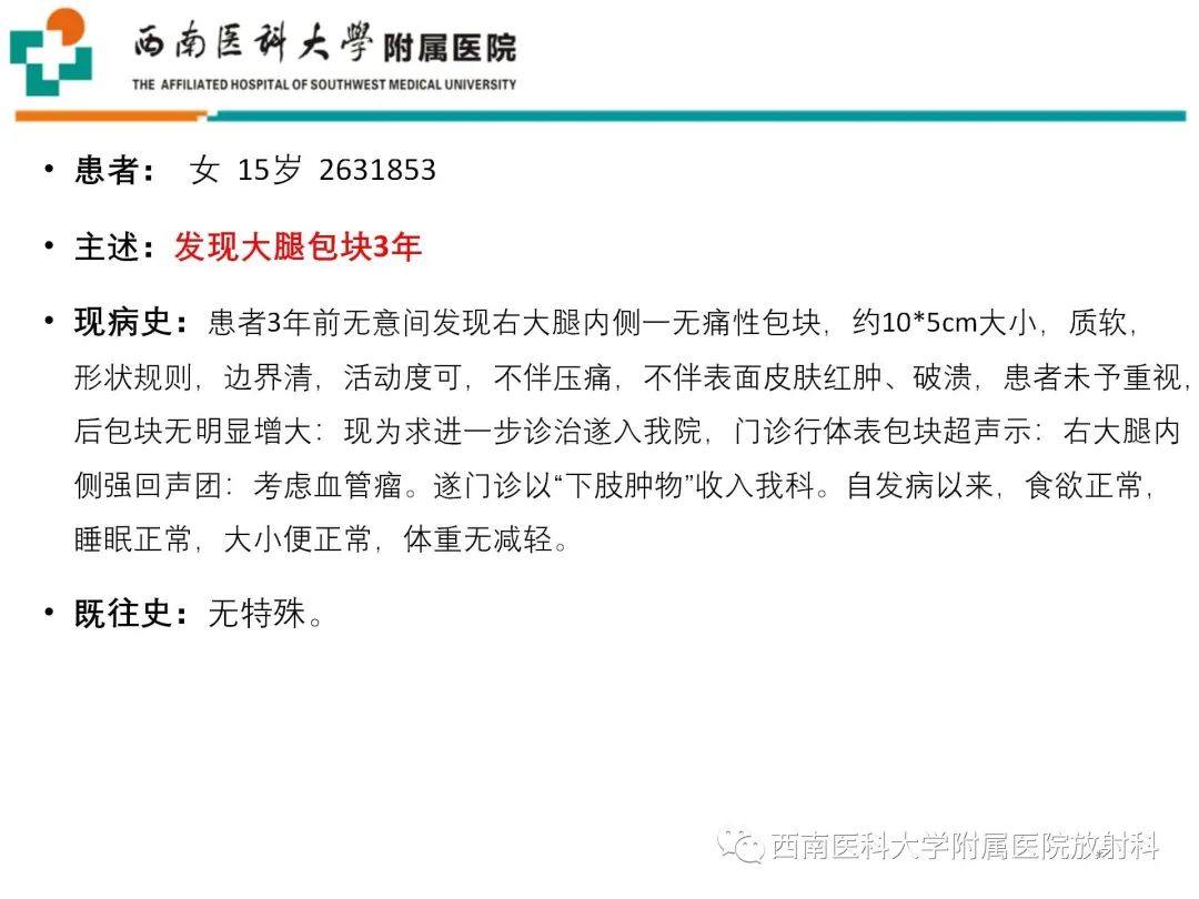 影像PPT - 【病例】大腿脂肪母细胞瘤1例MR影像诊断-1