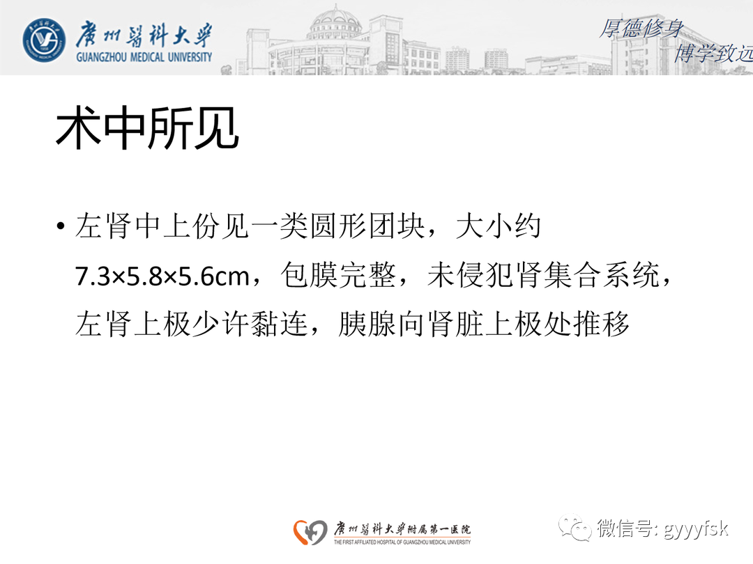 影像PPT - 【PPT】肾脏嫌色细胞癌-11