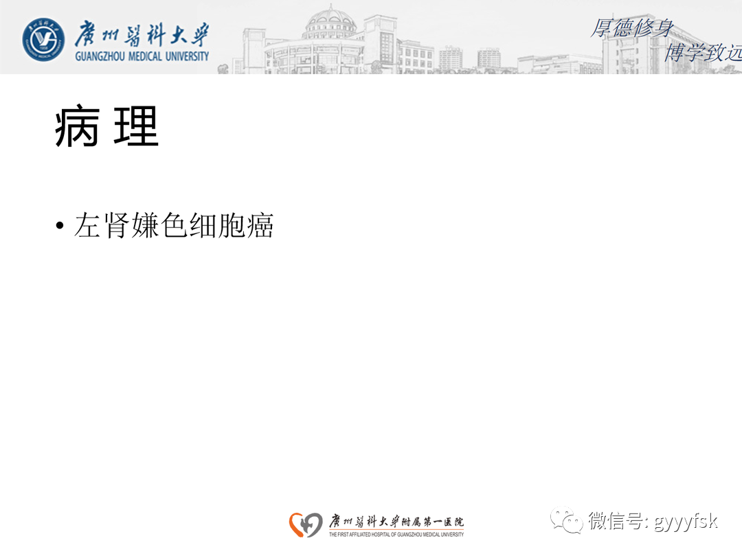 影像PPT - 【PPT】肾脏嫌色细胞癌-12