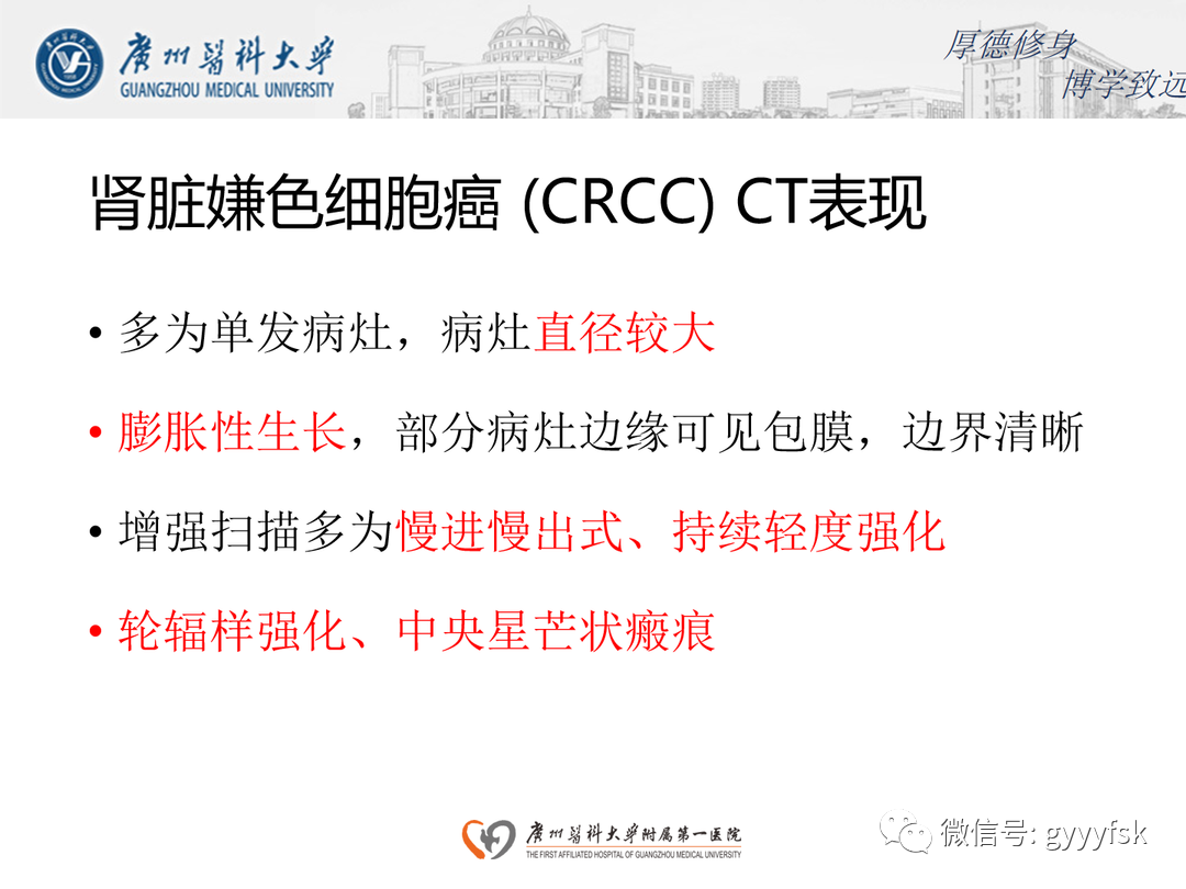 影像PPT - 【PPT】肾脏嫌色细胞癌-15