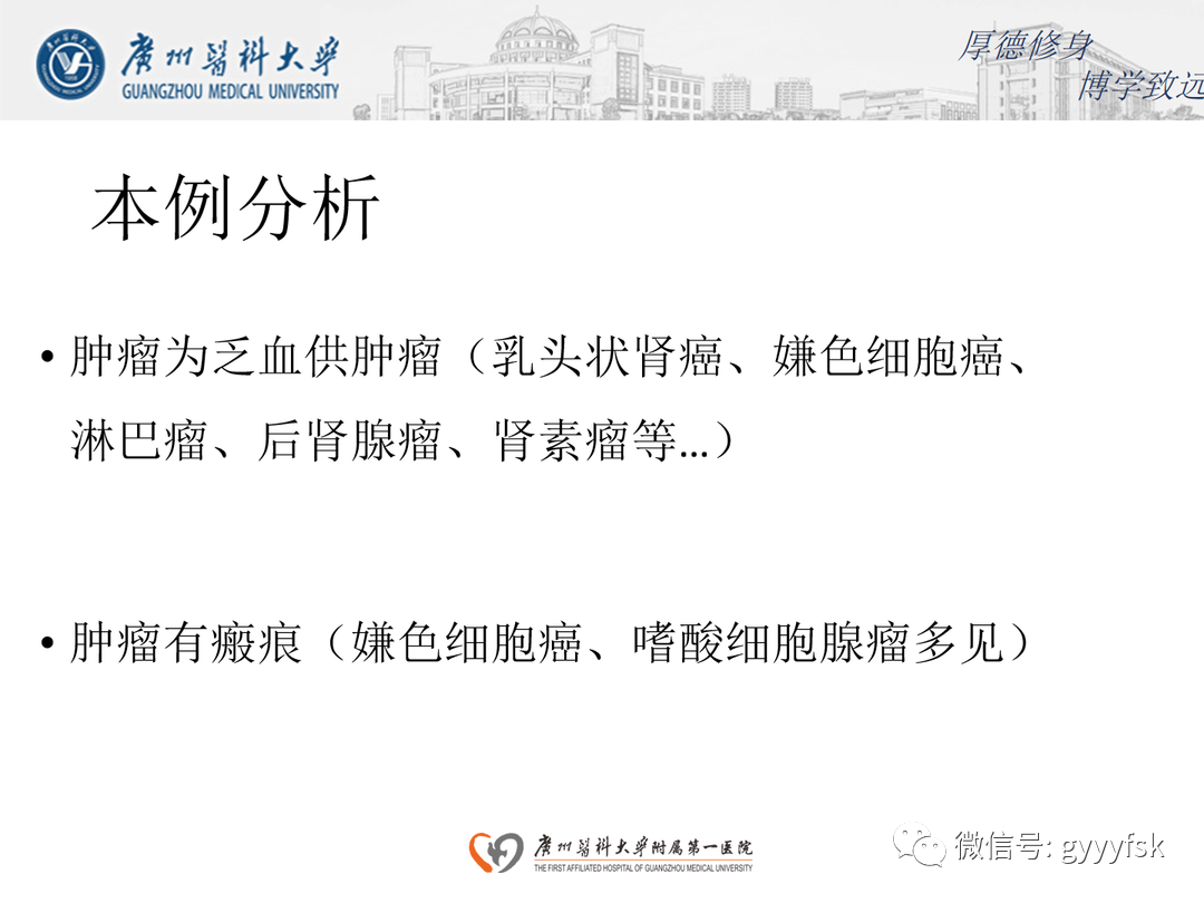 影像PPT - 【PPT】肾脏嫌色细胞癌-20