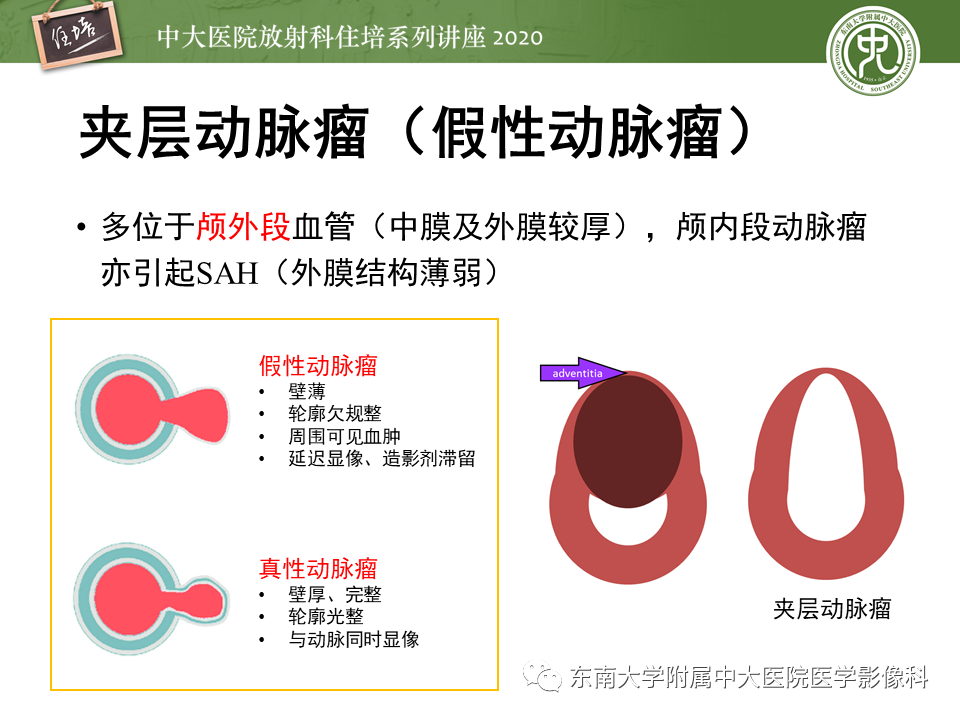 影像PPT - 【PPT】颈动脉夹层及夹层动脉瘤的影像诊断及评估-32