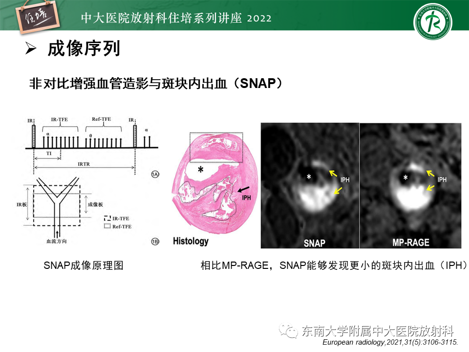 影像PPT - 【PPT】颅内MR血管壁成像技术与应用专家共识解读-12