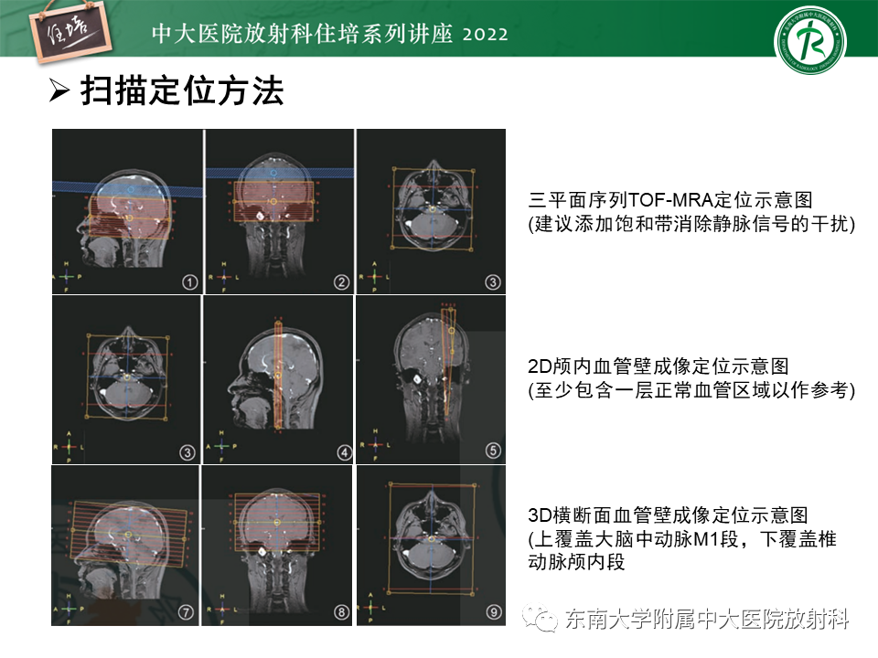 影像PPT - 【PPT】颅内MR血管壁成像技术与应用专家共识解读-15