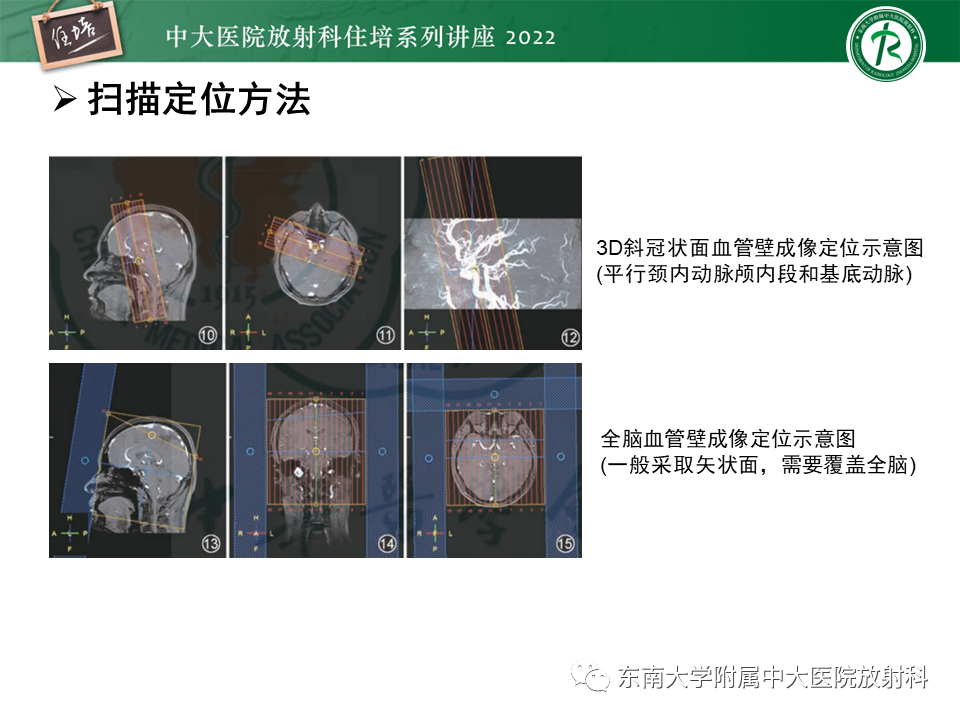影像PPT - 【PPT】颅内MR血管壁成像技术与应用专家共识解读-16