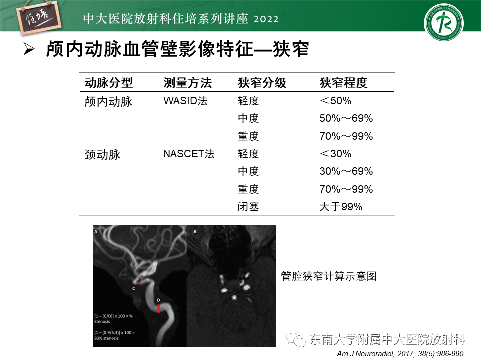 影像PPT - 【PPT】颅内MR血管壁成像技术与应用专家共识解读-21