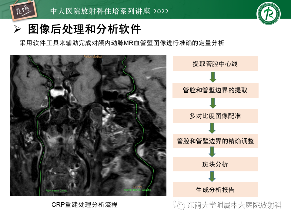 影像PPT - 【PPT】颅内MR血管壁成像技术与应用专家共识解读-28