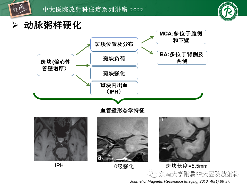 影像PPT - 【PPT】颅内MR血管壁成像技术与应用专家共识解读-32