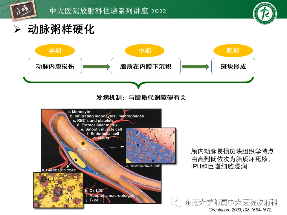 影像PPT - 【PPT】颅内MR血管壁成像技术与应用专家共识解读-31